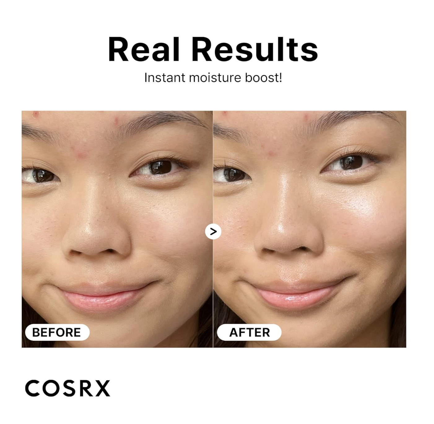 COSRX The Hyaluronic Acid 3 Serum - serumas su hialurono rugštimi, 20ml